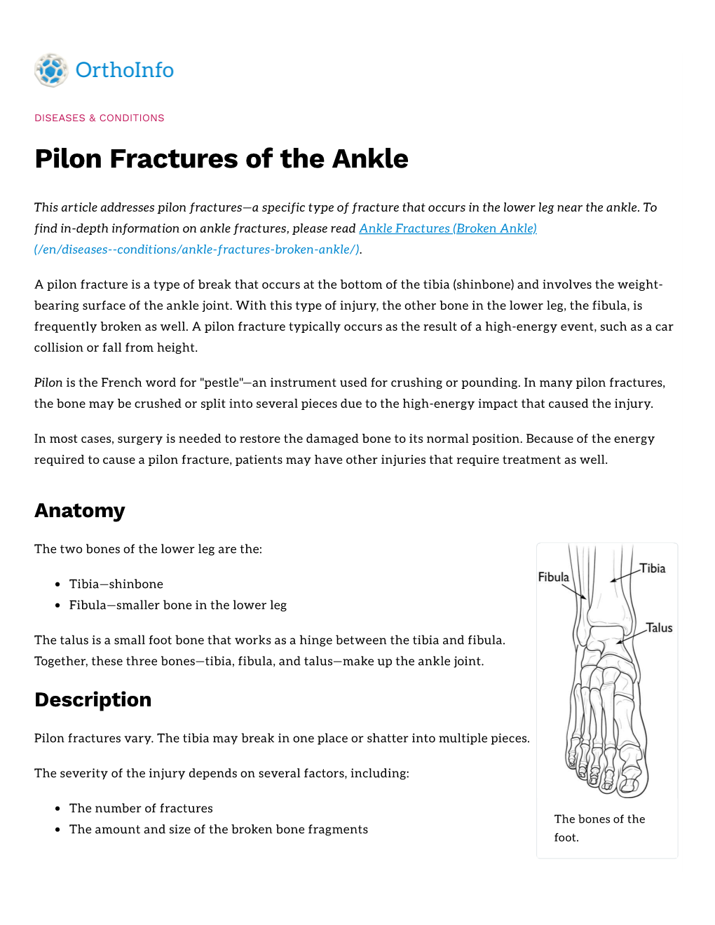 Pilon Fractures of the Ankle