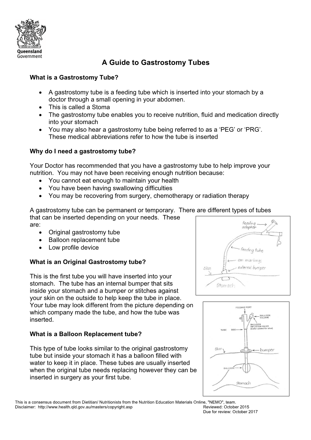 A Guide to Gastrostomy Tubes