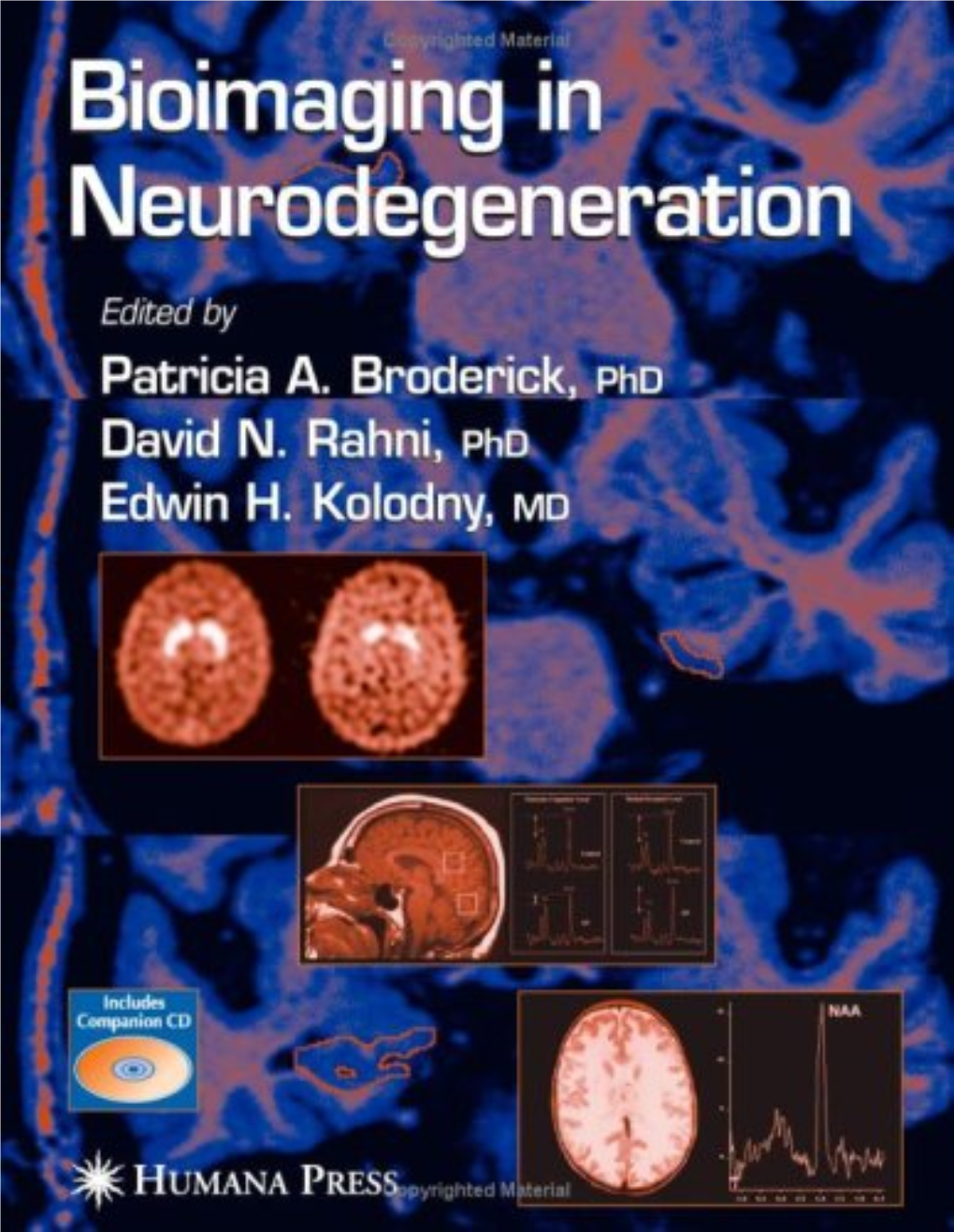 Bioimaging in Neurodegeneration Bioimaging in Neurodegeneration