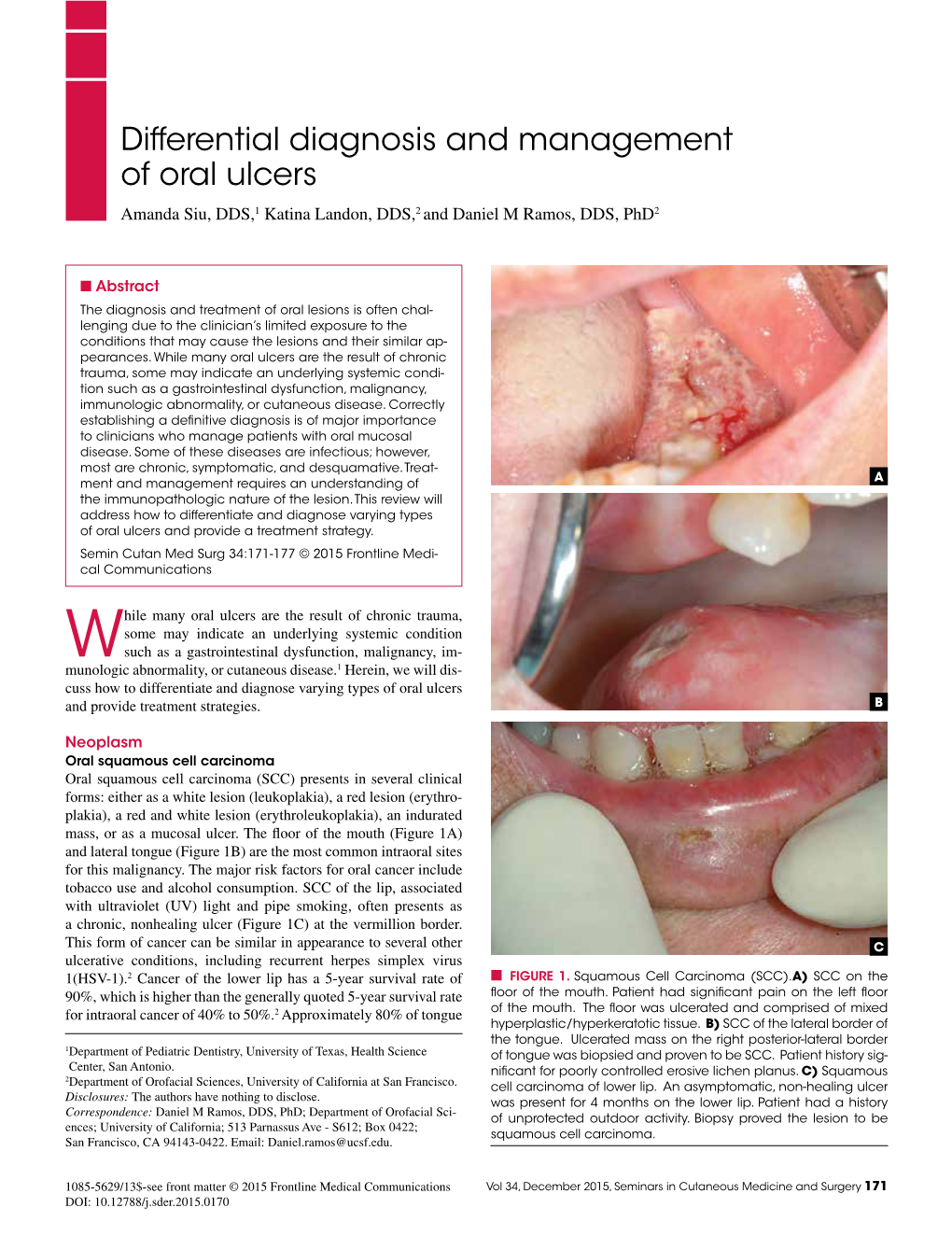 Differential Diagnosis and Management of Oral Ulcers Amanda Siu, DDS,1 Katina Landon, DDS,2 and Daniel M Ramos, DDS, Phd2