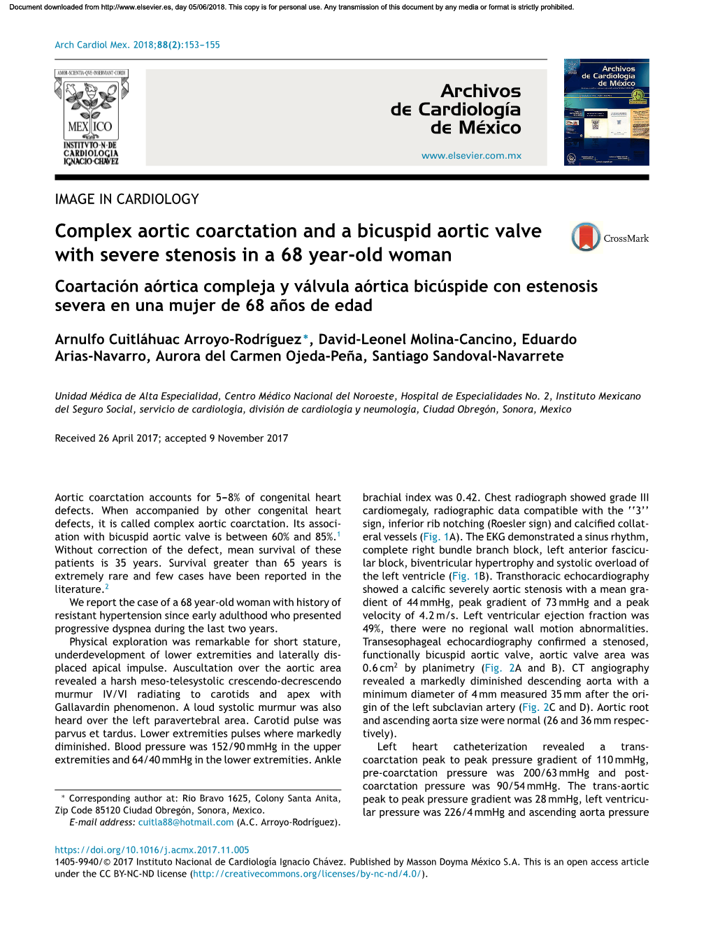 Complex Aortic Coarctation and a Bicuspid Aortic Valve