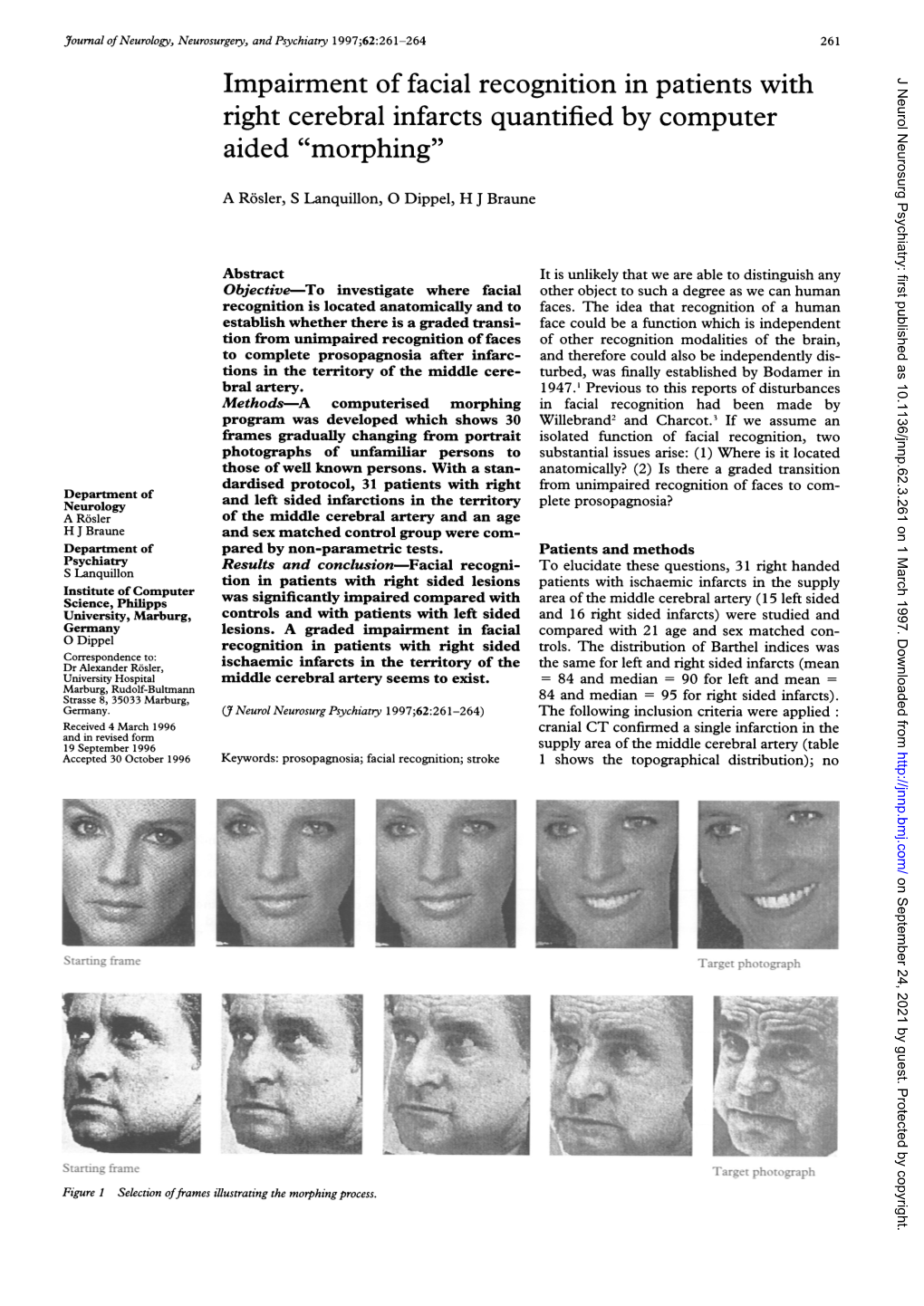 Impairment of Facial Recognition in Patients with Right Cerebral Infarcts