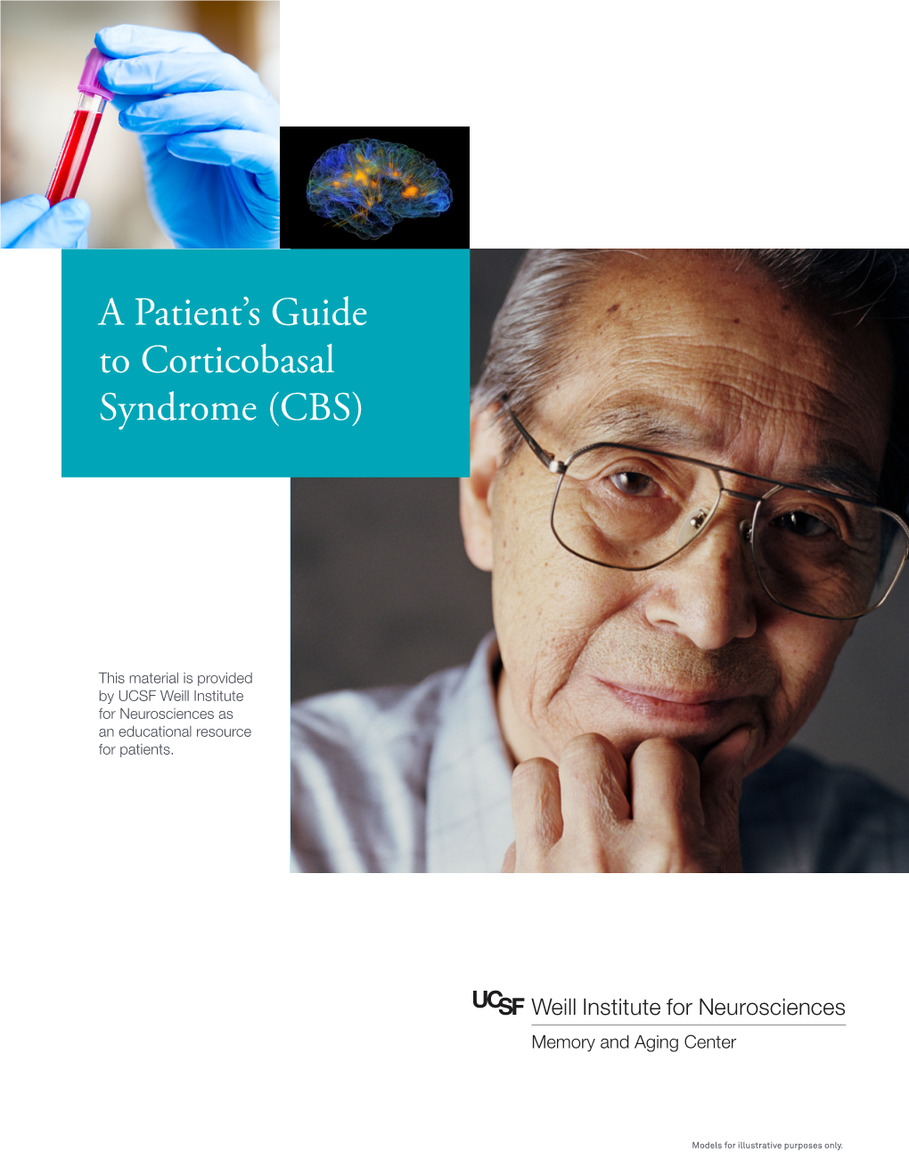 A Patient's Guide to Corticobasal Syndrome