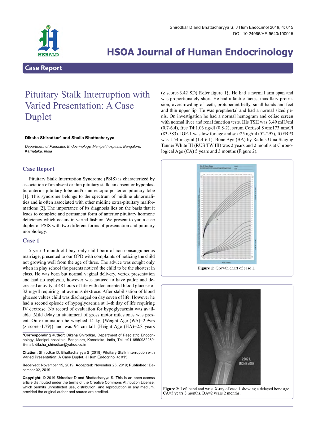 Pituitary Stalk Interruption with Varied Presentation: a Case Duplet