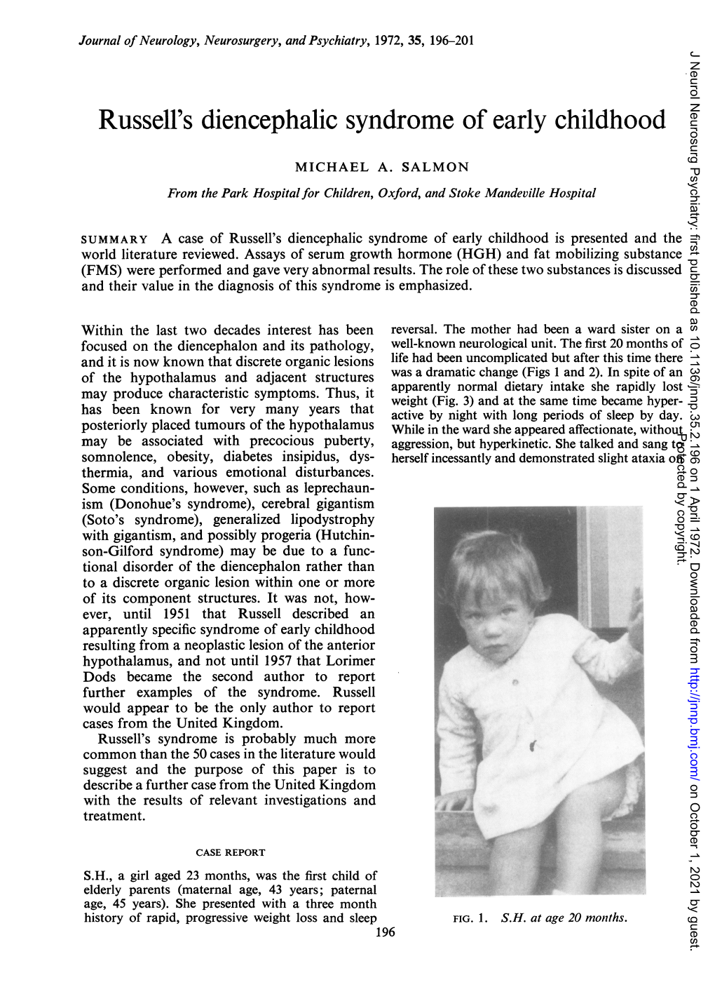 Russell's Diencephalic Syndrome of Early Childhood