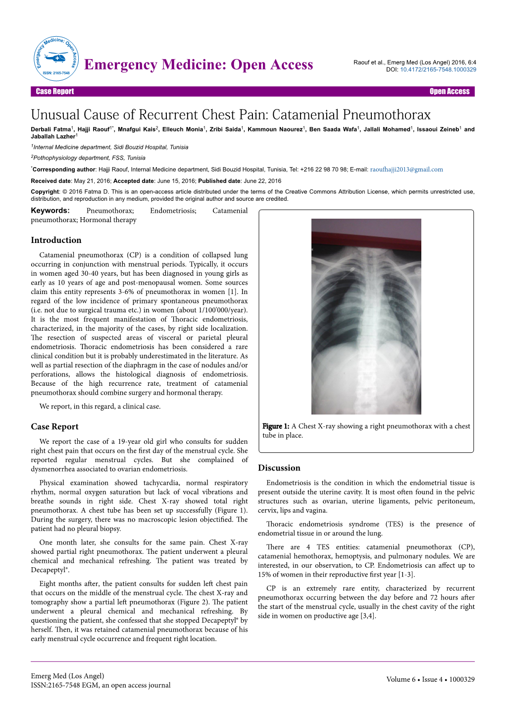 Catamenial Pneumothorax