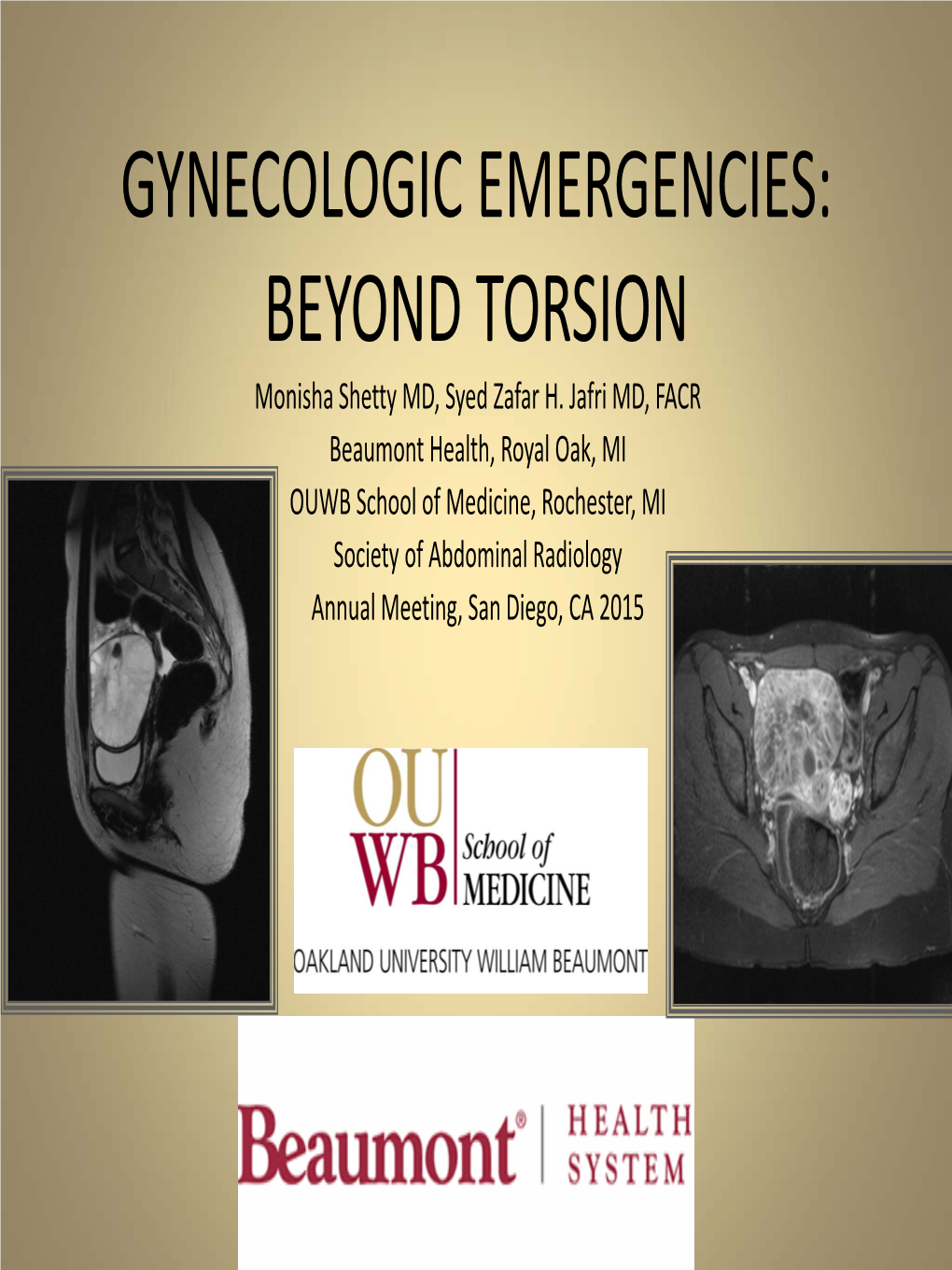 81. Gynecologic Emergencies: Beyond Torsion