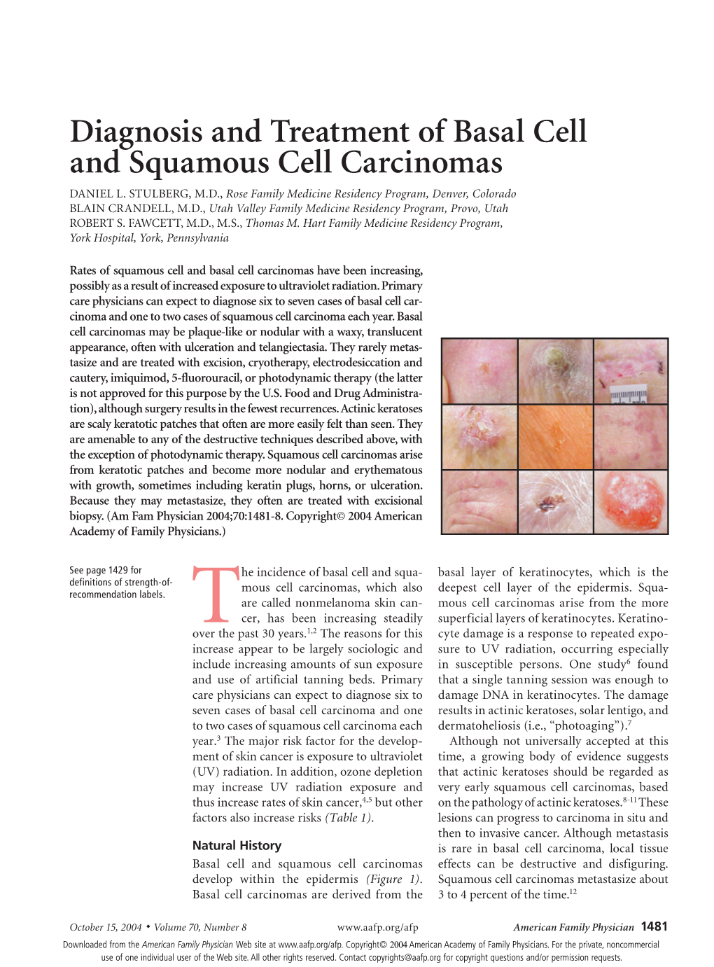 Diagnosis and Treatment of Basal Cell and Squamous Cell Carcinomas DANIEL L