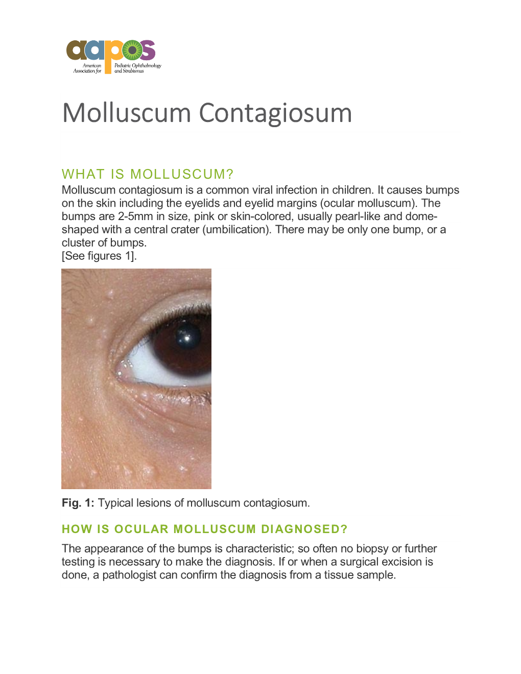 Molluscum Contagiosum