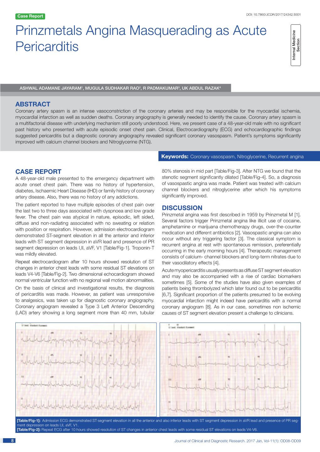 Prinzmetals Angina Masquerading As Acute Pericarditis