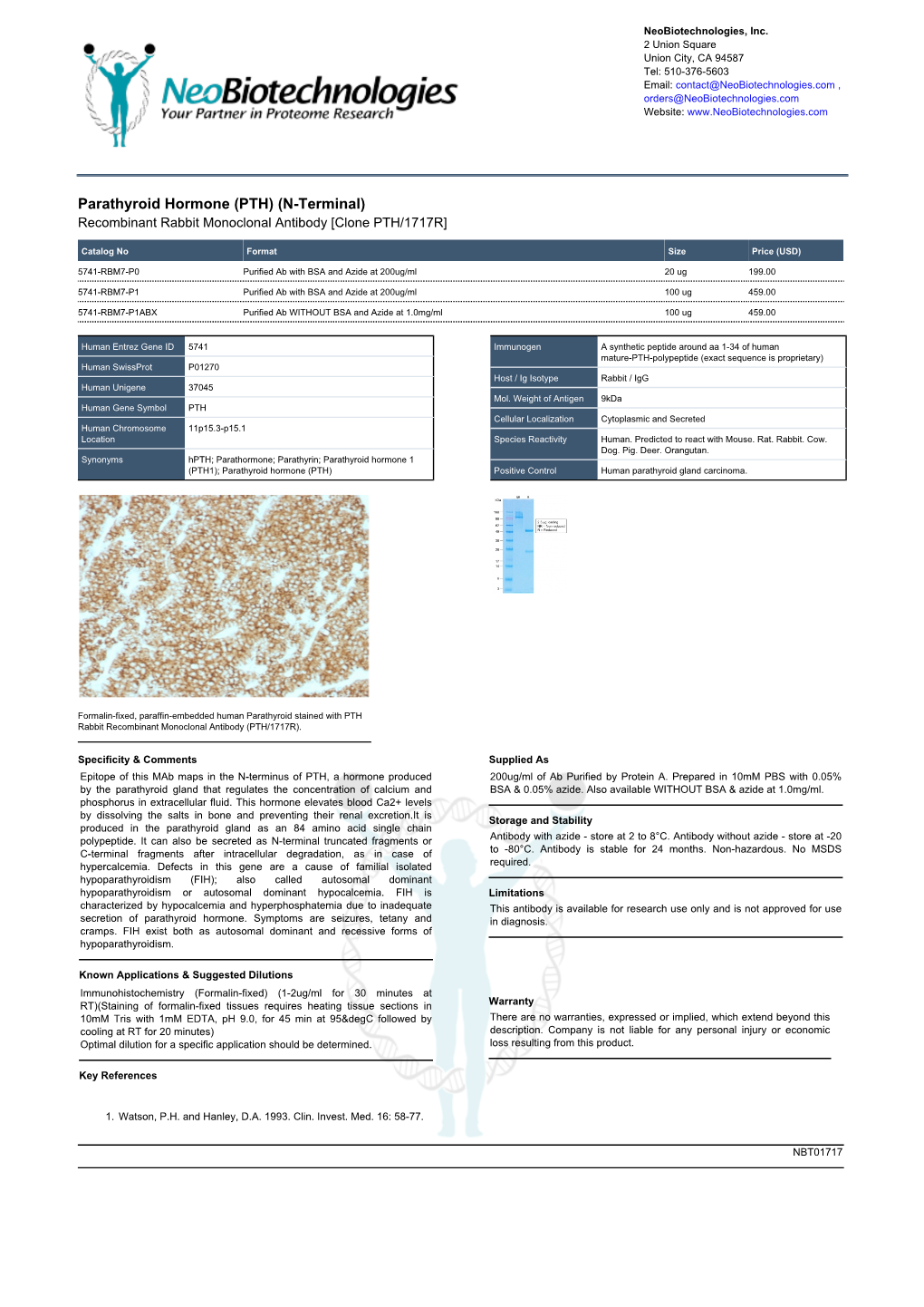 Parathyroid Hormone (PTH) (N-Terminal) Recombinant Rabbit Monoclonal Antibody [Clone PTH/1717R]