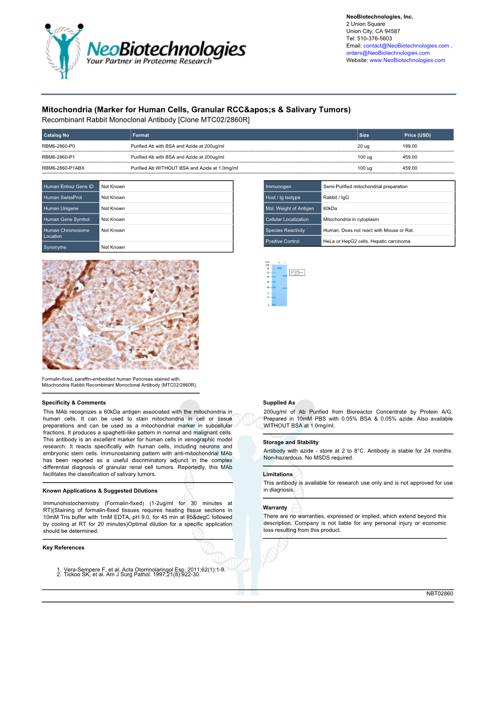 Mitochondria (Marker for Human Cells, Granular Rccs & Salivary Tumors) Recombinant Rabbit Monoclonal Antibody [Clone MTC02/2860R]