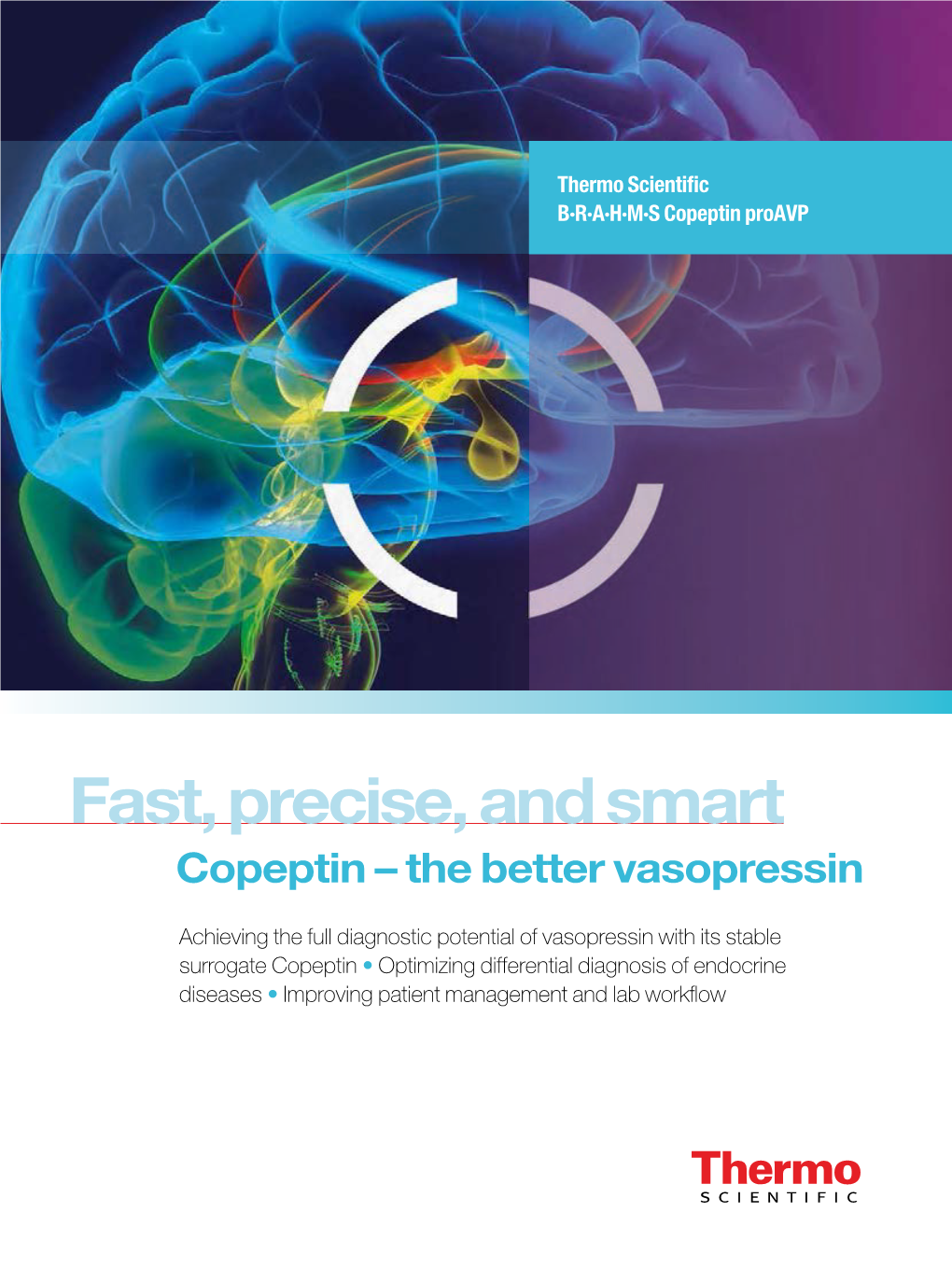 Copeptin – the Better Vasopressin