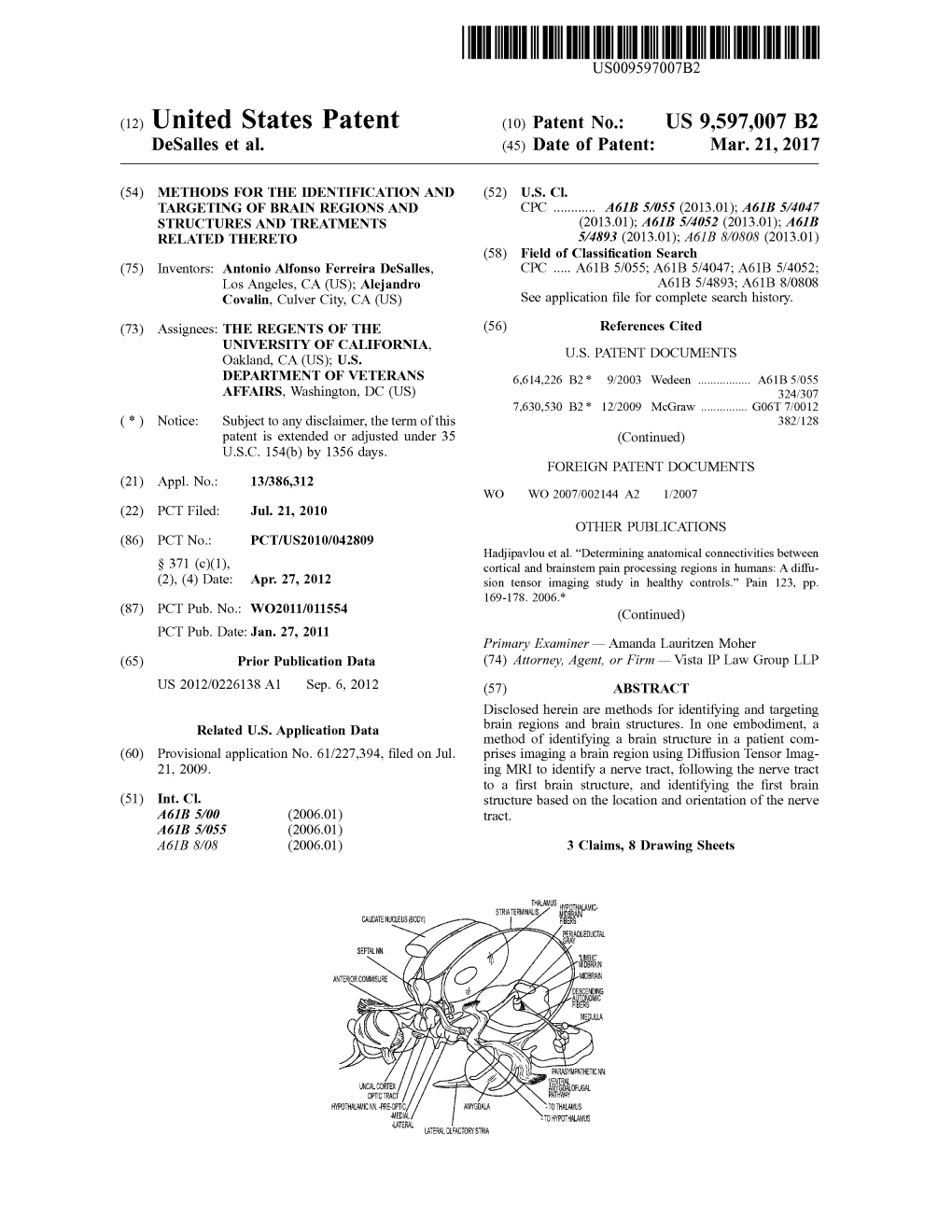 (12) United States Patent (10) Patent No.: US 9,597,007 B2 Desalles Et Al