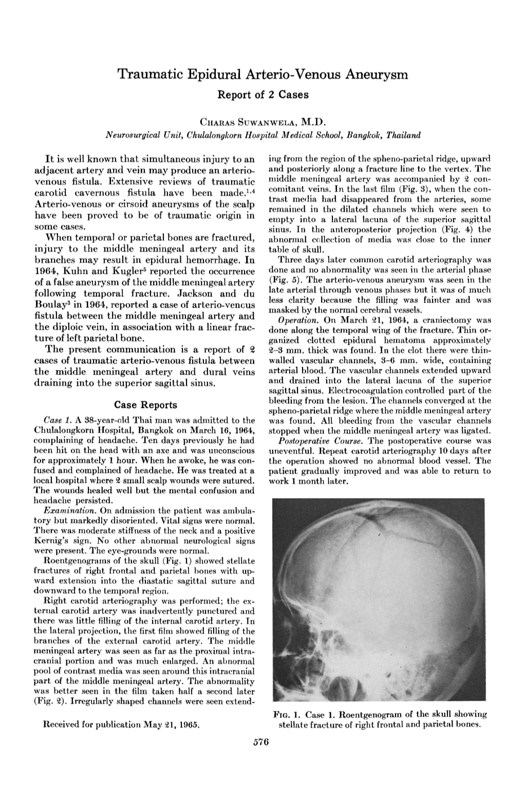 Traumatic Epidural Arterio-Venous Aneurysm Report of 2 Cases