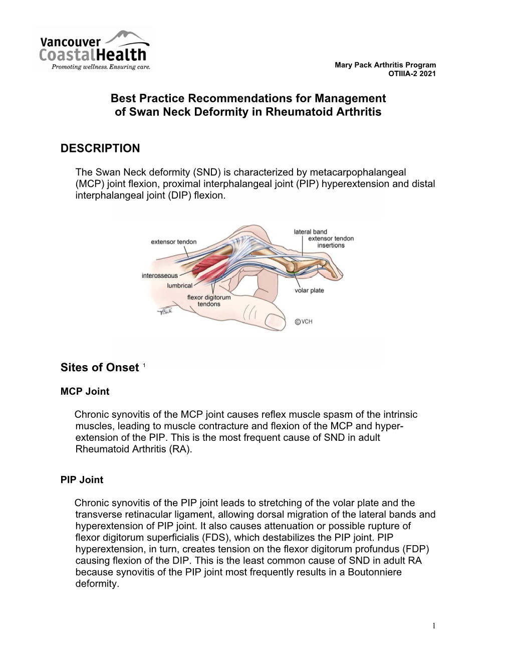 Best Practice Recommendations for Management of Swan Neck Deformity in Rheumatoid Arthritis
