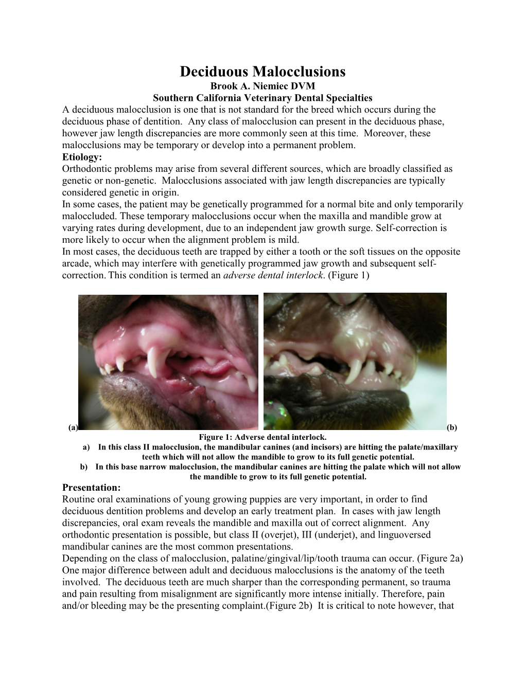 Deciduous Malocclusions Brook A