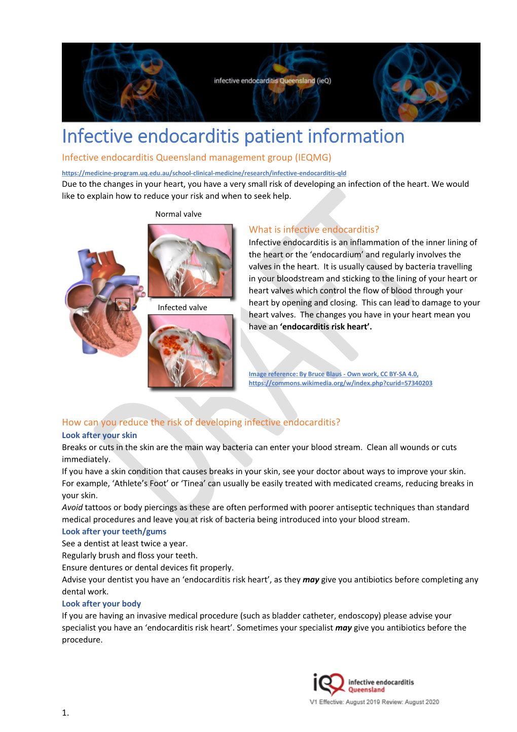 Infective Endocarditis Patient Information