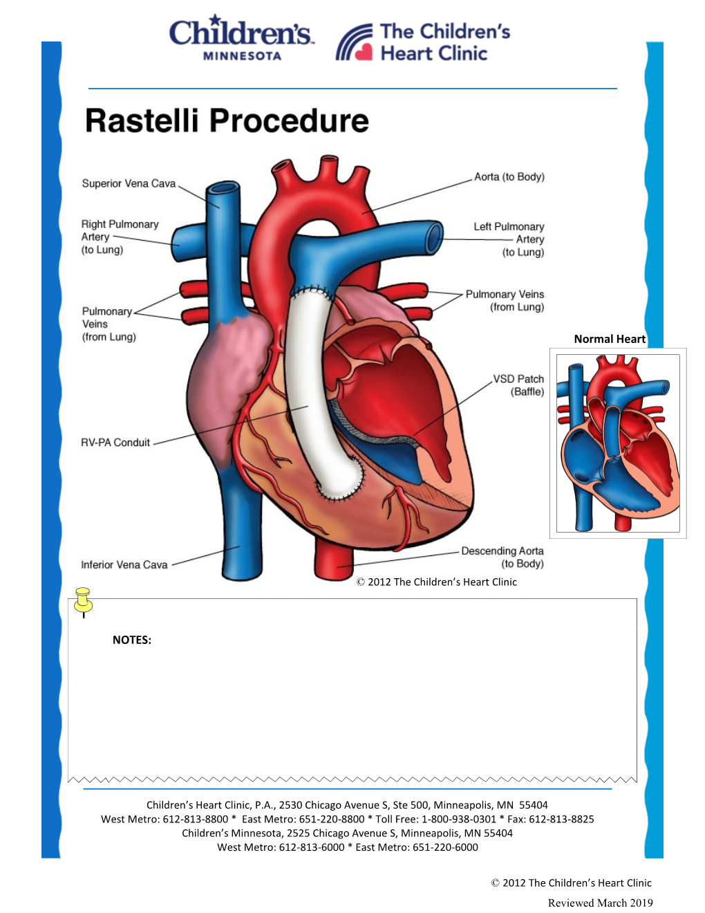 Rastelli Procedure