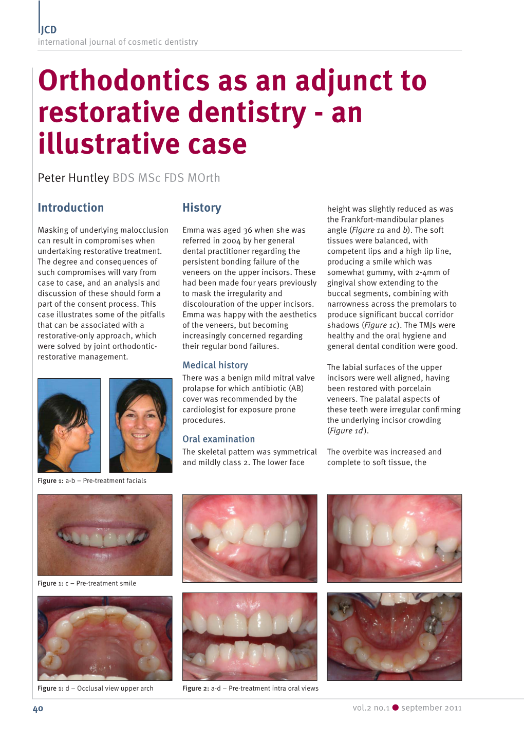 Orthodontics As an Adjunct to Restorative Dentistry - an Illustrative Case Peter Huntley BDS Msc FDS Morth