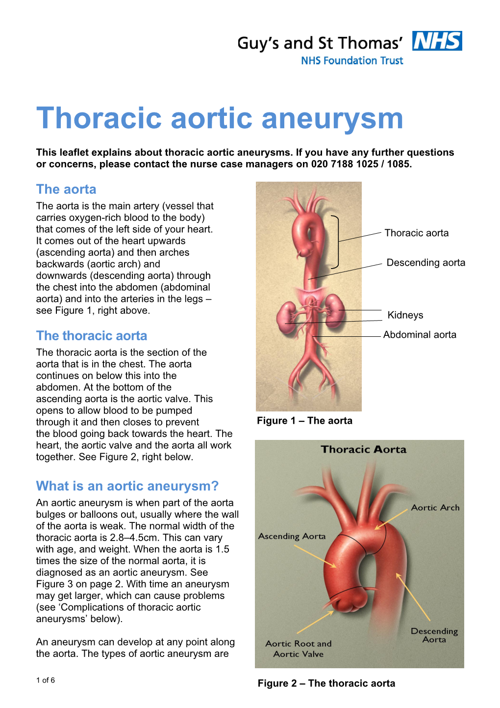 Thoracic Aortic Aneurysm