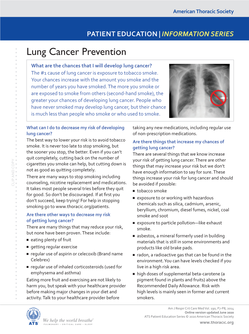 Lung Cancer Prevention