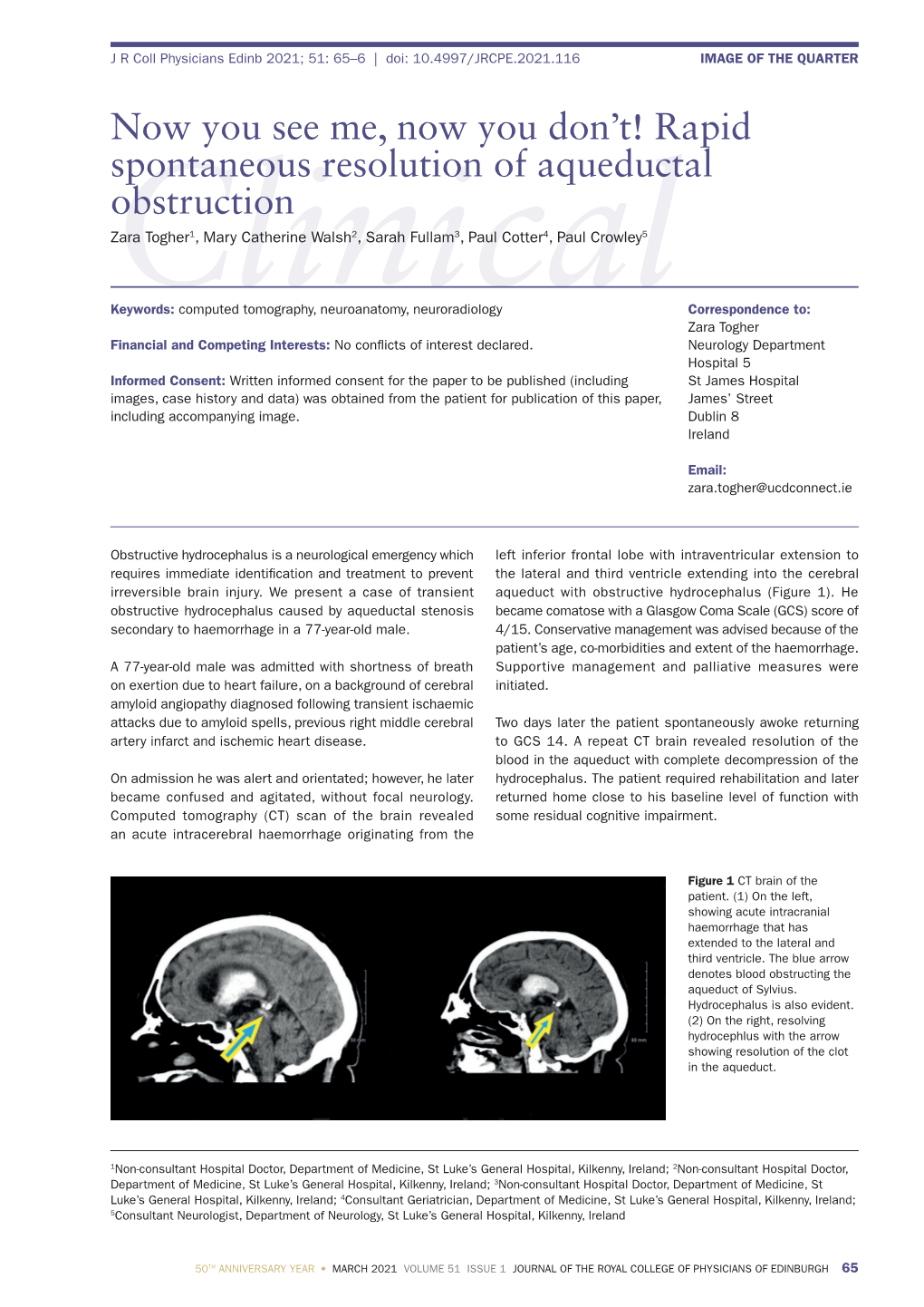 Rapid Spontaneous Resolution of Aqueductal Obstruction Zara Togher1, Mary Catherine Walsh2, Sarah Fullam3, Paul Cotter4, Paul Crowley5