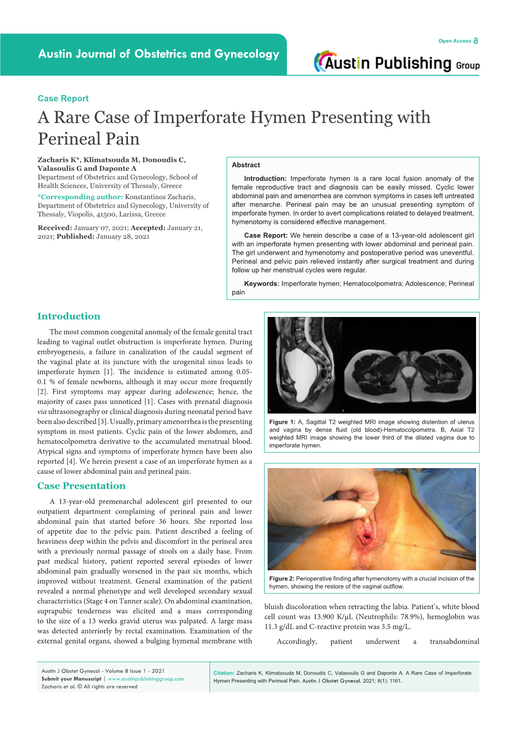 A Rare Case of Imperforate Hymen Presenting with Perineal Pain