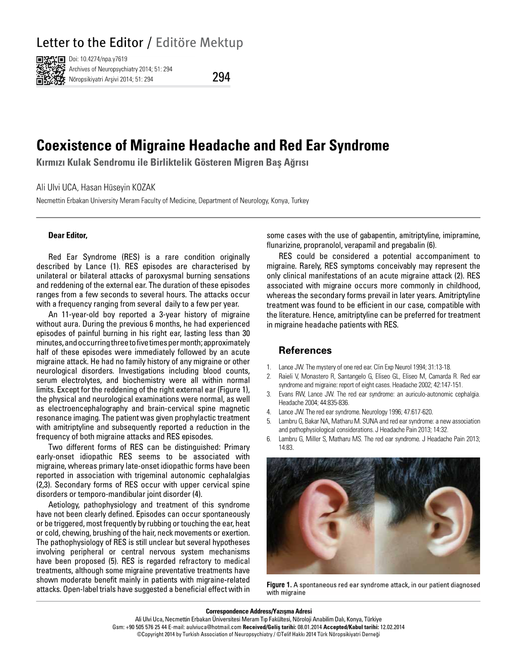 Coexistence of Migraine Headache and Red Ear Syndrome Kırmızı Kulak Sendromu Ile Birliktelik Gösteren Migren Baş Ağrısı