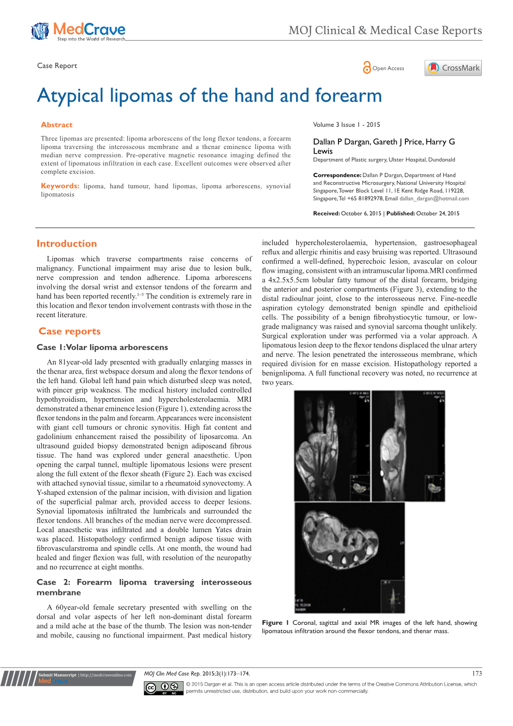 Atypical Lipomas of the Hand and Forearm