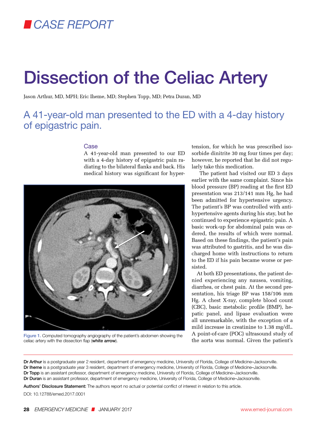 Dissection of the Celiac Artery