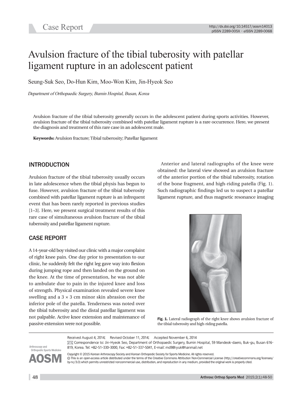 Avulsion Fracture Of The Tibial Tuberosity With Patellar Ligament Rupture In An Adolescent