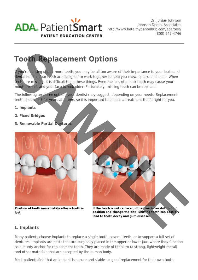 ADA Patient Smart | Tooth Replacement Options