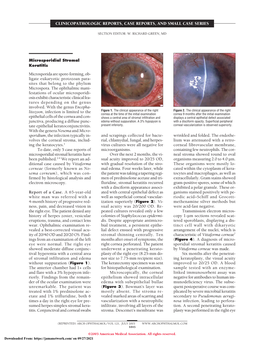 Microsporidial Stromal Keratitis