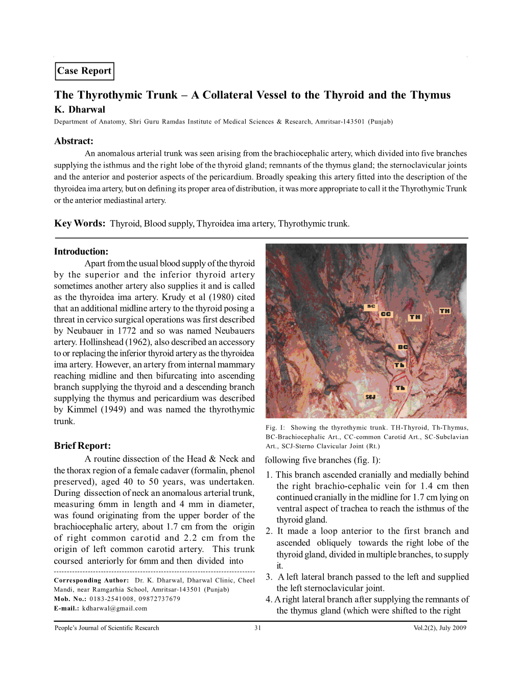 The Thyrothymic Trunk – a Collateral Vessel to the Thyroid and the Thymus K