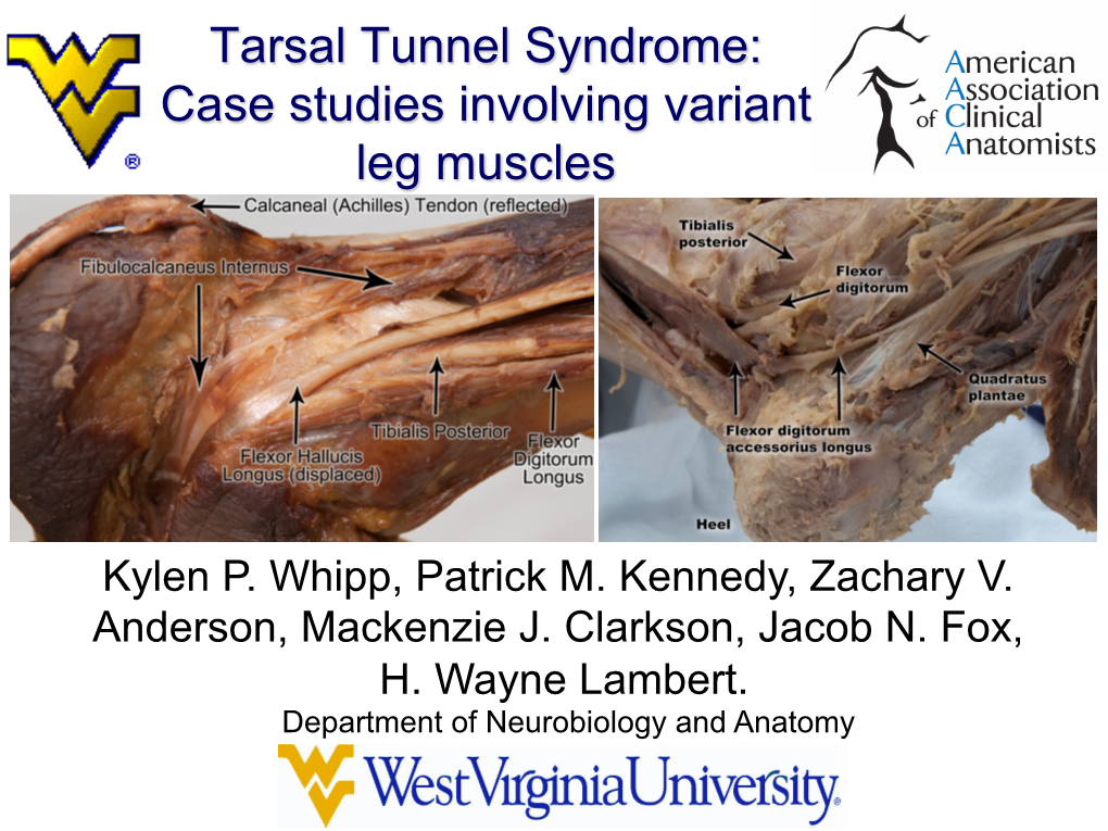 Tarsal Tunnel Syndrome: Case Studies Involving Variant Leg Muscles