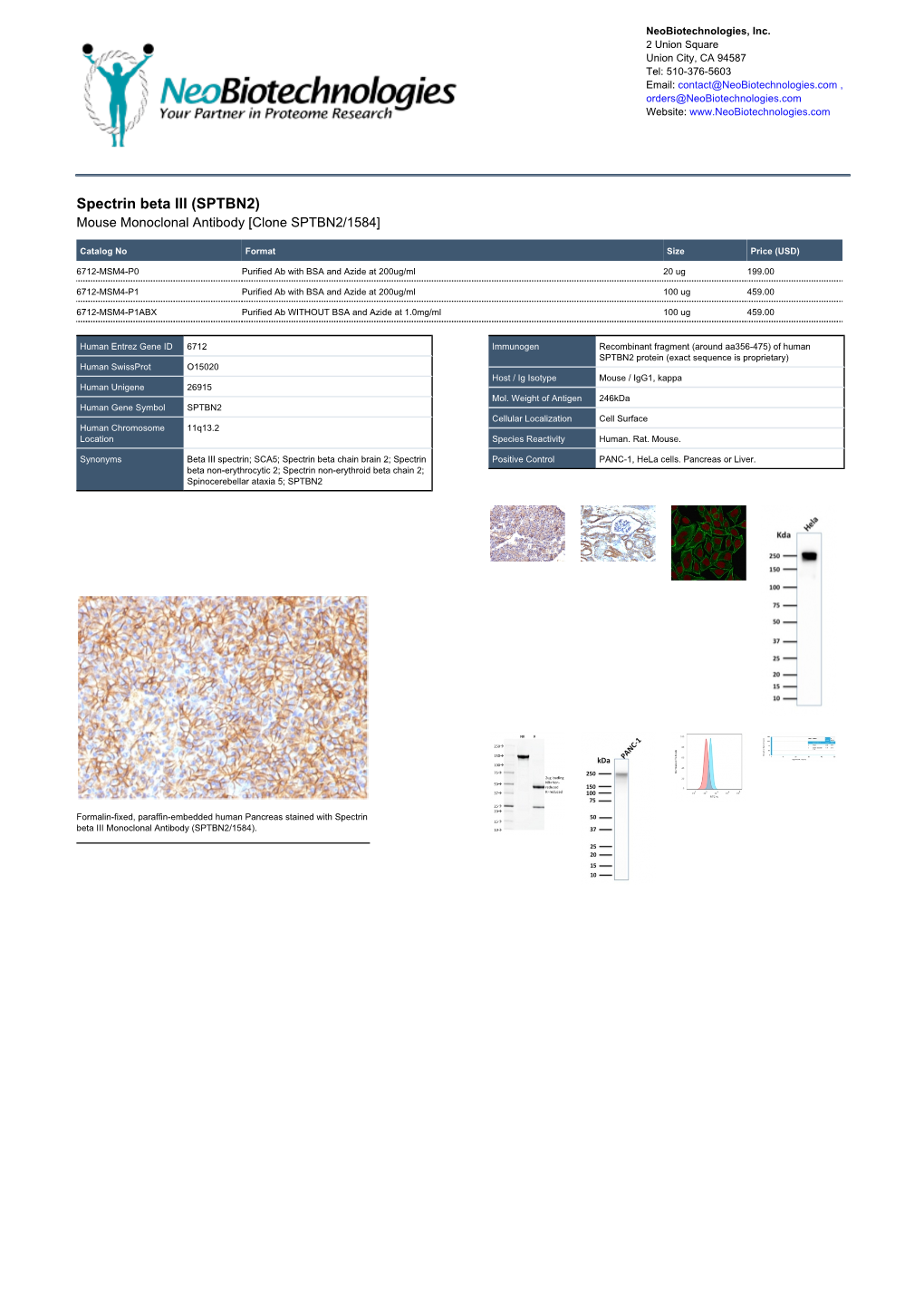 Spectrin Beta III (SPTBN2) Mouse Monoclonal Antibody [Clone SPTBN2/1584]