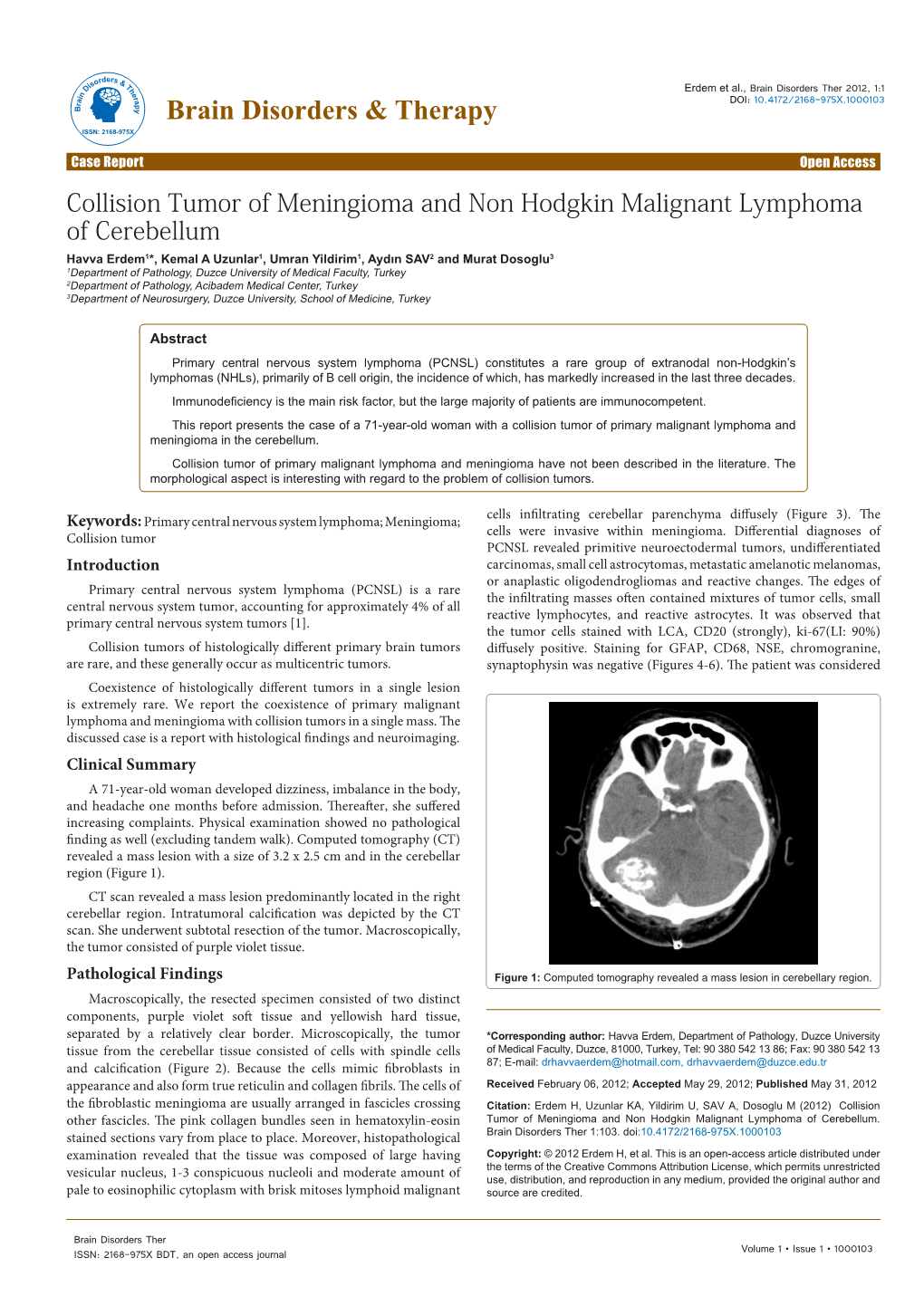 Collision Tumor of Meningioma and Non Hodgkin Malignant Lymphoma