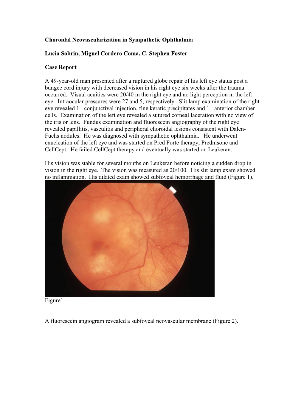Choroidal Neovascularization in Sympathetic Ophthalmia