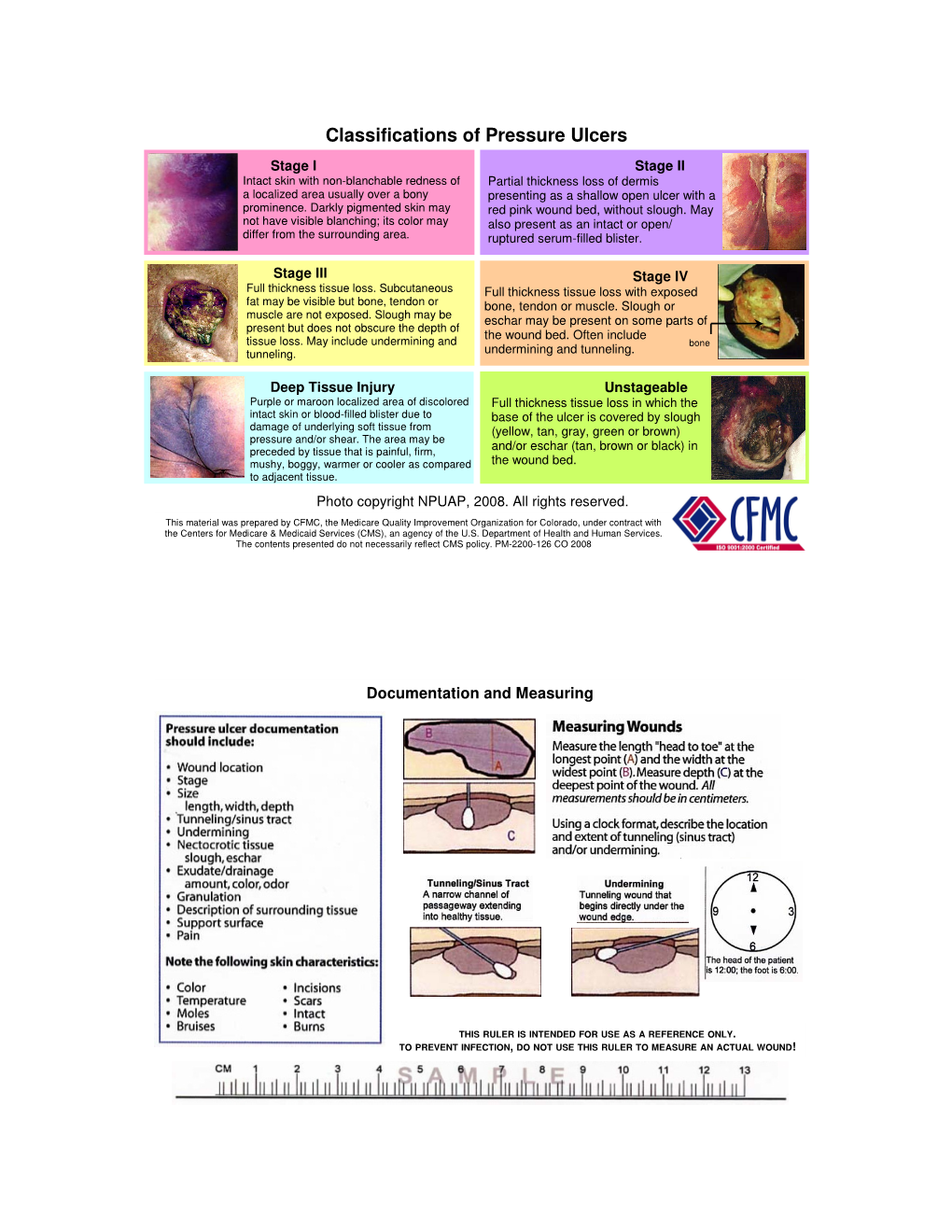 Classifications of Pressure Ulcers