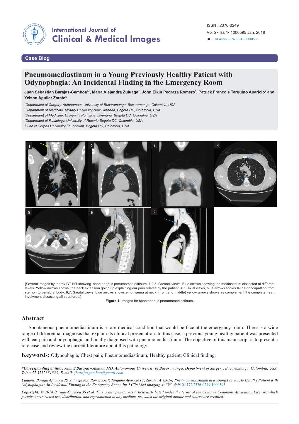 Pneumomediastinum in a Young Previously Healthy Patient with Odynophagia: an Incidental Finding in the Emergency Room