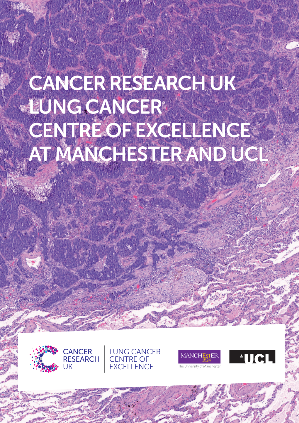 Cancer Research Uk Lung Cancer Centre of Excellence at Manchester and Ucl