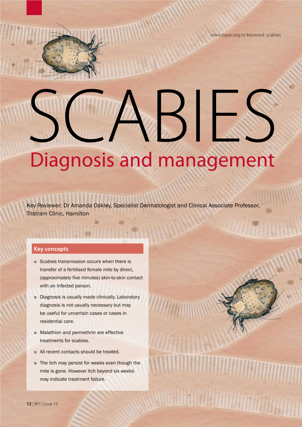 Scabies SCABIES Diagnosis and Management