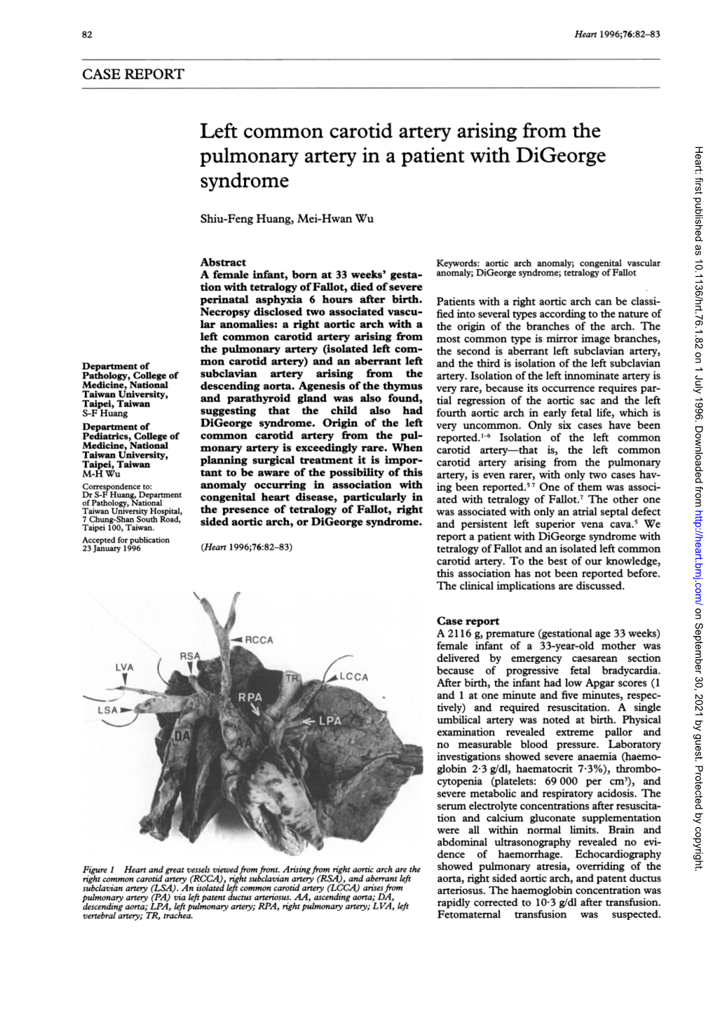 Left Common Carotid Artery Arising from the Pulmonary Artery in A