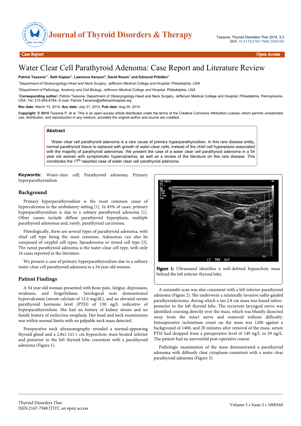 Water Clear Cell Parathyroid Adenoma: Case Report And