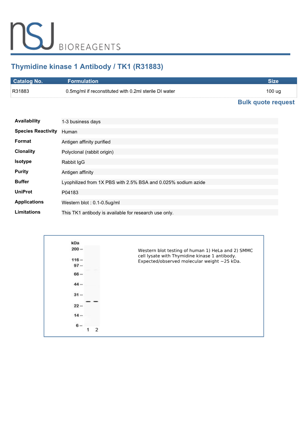 Thymidine Kinase 1 Antibody / TK1 (R31883)