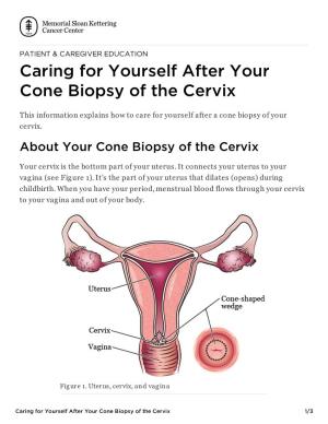 Caring for Yourself After Your Cone Biopsy of the Cervix | Memorial Sloan Kettering Cancer Center