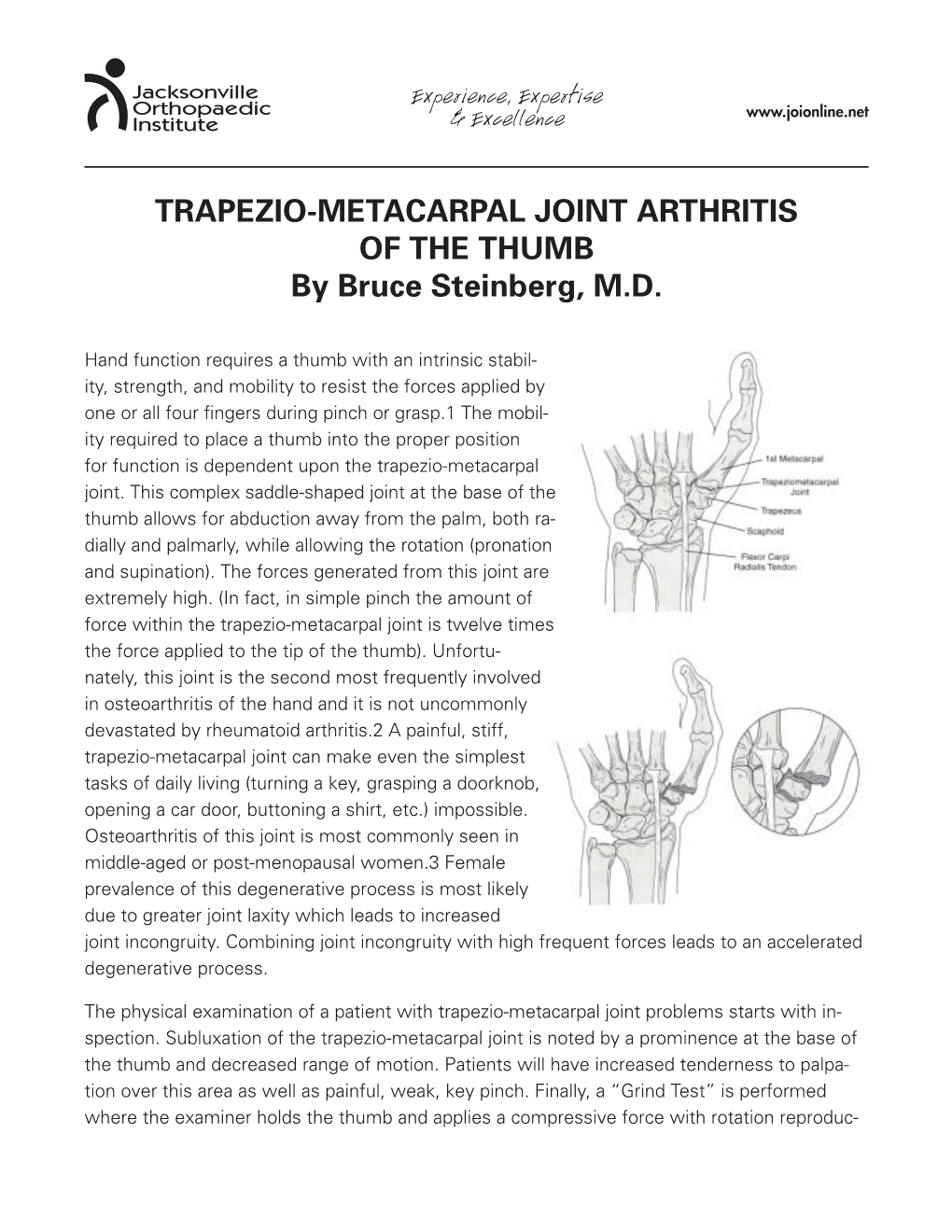 TRAPEZIO-METACARPAL JOINT ARTHRITIS of the THUMB by Bruce Steinberg, M.D