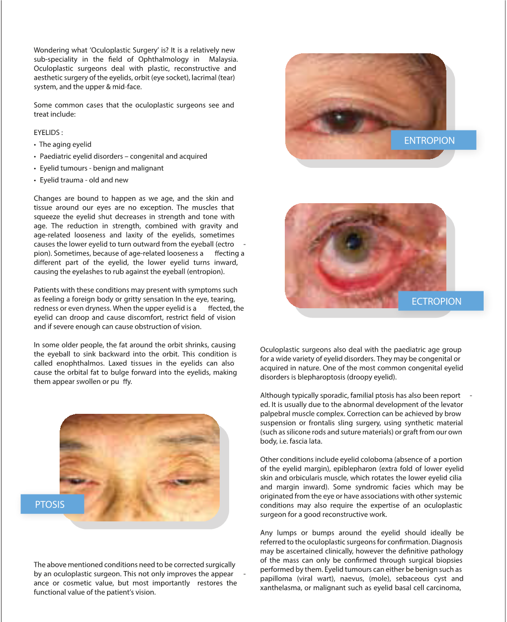 Ptosis Entropion Ectropion