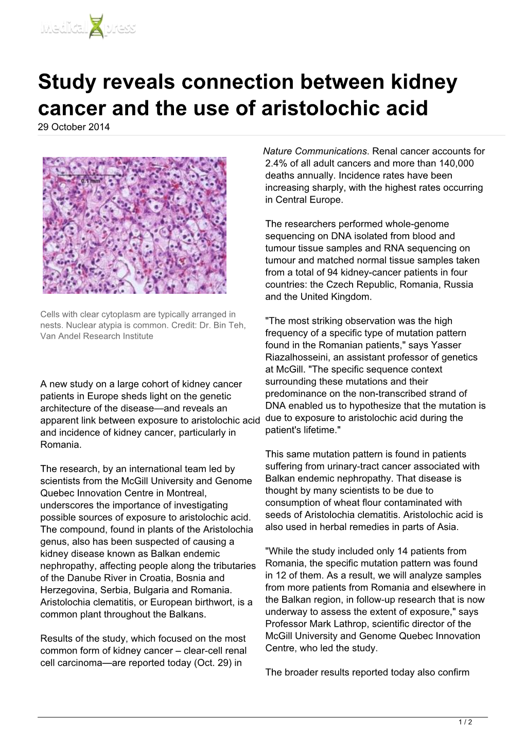 Study Reveals Connection Between Kidney Cancer and the Use of Aristolochic Acid 29 October 2014